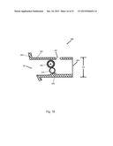 Arthroscopic Method and Apparatus for Rotator Cuff Repair diagram and image