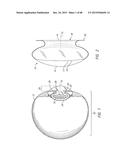 PROSTHETIC CAPSULAR DEVICES, SYSTEMS, AND METHODS diagram and image