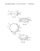 PROSTHETIC CAPSULAR DEVICES, SYSTEMS, AND METHODS diagram and image