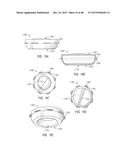 PROSTHETIC CAPSULAR DEVICES, SYSTEMS, AND METHODS diagram and image