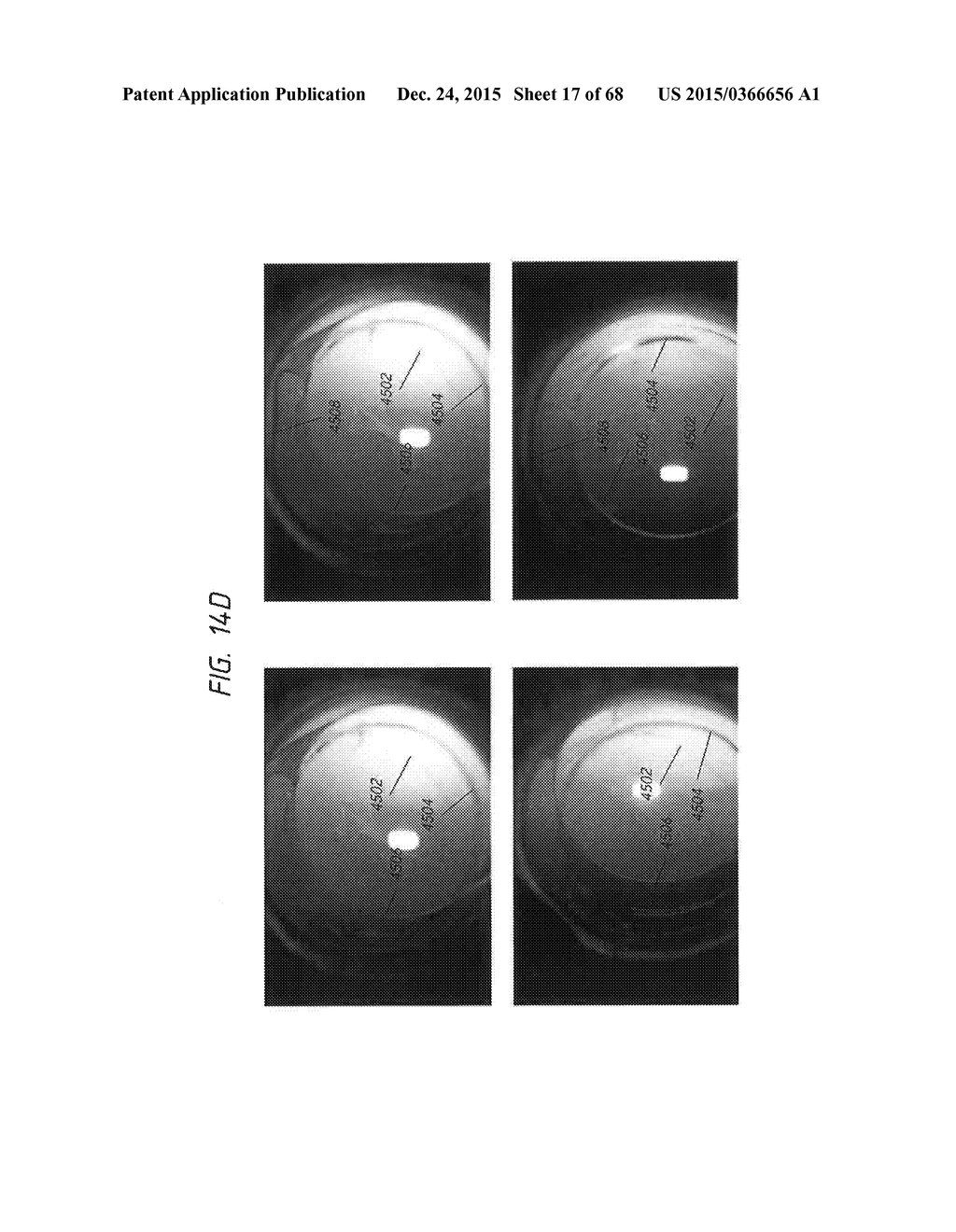 PROSTHETIC CAPSULAR DEVICES, SYSTEMS, AND METHODS - diagram, schematic, and image 18