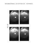 PROSTHETIC CAPSULAR DEVICES, SYSTEMS, AND METHODS diagram and image