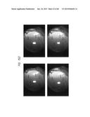 PROSTHETIC CAPSULAR DEVICES, SYSTEMS, AND METHODS diagram and image