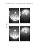 PROSTHETIC CAPSULAR DEVICES, SYSTEMS, AND METHODS diagram and image