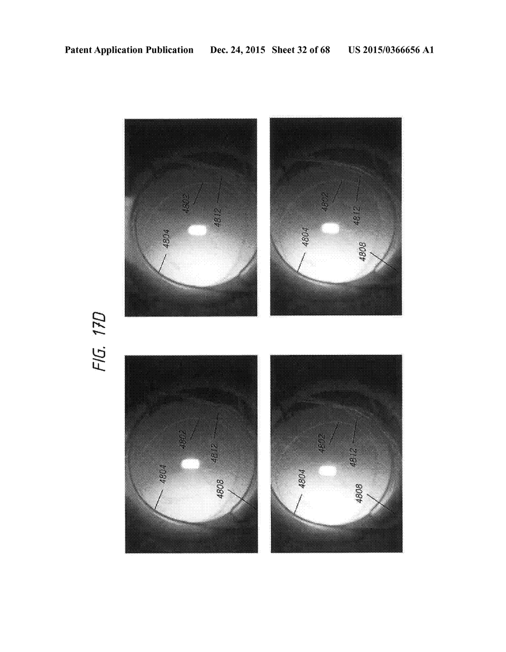 PROSTHETIC CAPSULAR DEVICES, SYSTEMS, AND METHODS - diagram, schematic, and image 33