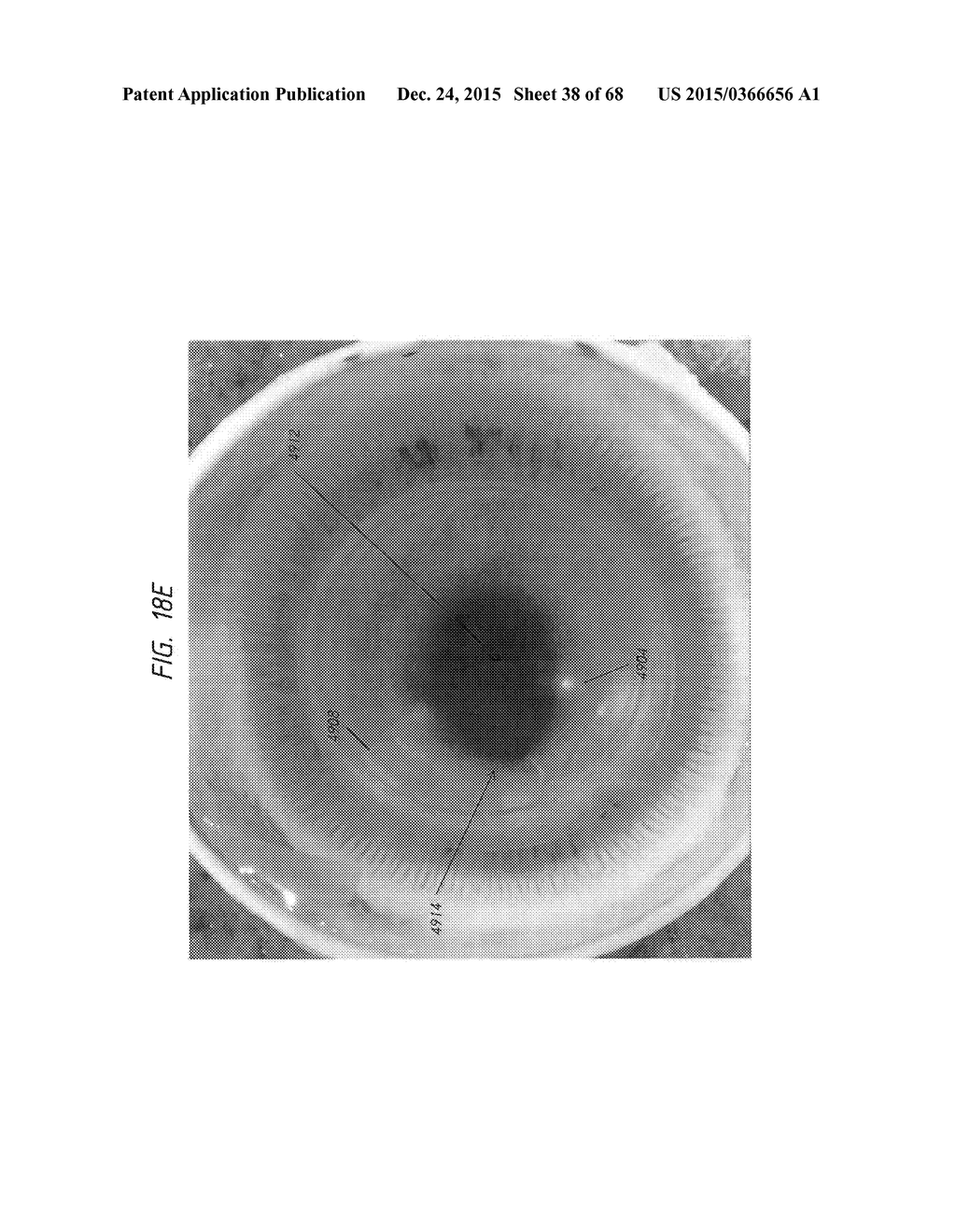 PROSTHETIC CAPSULAR DEVICES, SYSTEMS, AND METHODS - diagram, schematic, and image 39