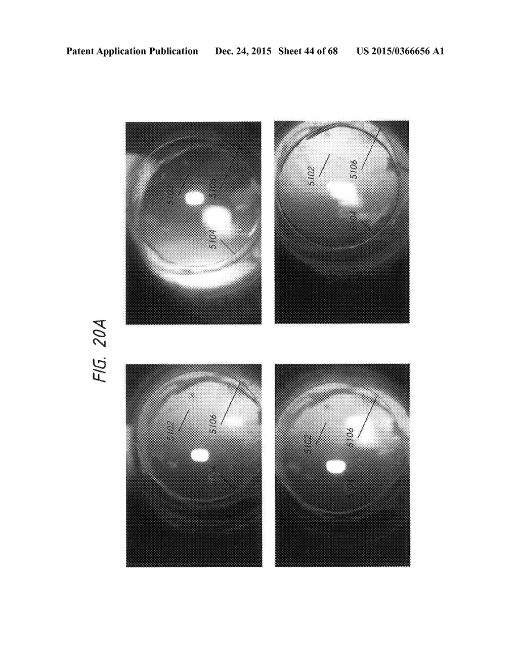 PROSTHETIC CAPSULAR DEVICES, SYSTEMS, AND METHODS - diagram, schematic, and image 45