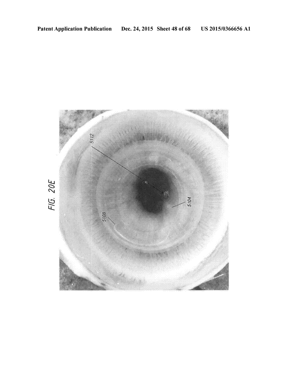 PROSTHETIC CAPSULAR DEVICES, SYSTEMS, AND METHODS - diagram, schematic, and image 49