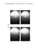 PROSTHETIC CAPSULAR DEVICES, SYSTEMS, AND METHODS diagram and image