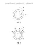 CORNEAL IMPLANT EDGES AND METHODS OF USE diagram and image