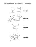 CORNEAL IMPLANT EDGES AND METHODS OF USE diagram and image