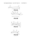 CORNEAL IMPLANT EDGES AND METHODS OF USE diagram and image