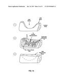 PERFORATED MEMBRANE FOR GUIDED BONE AND TISSUE REGENERATION diagram and image