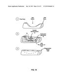 PERFORATED MEMBRANE FOR GUIDED BONE AND TISSUE REGENERATION diagram and image