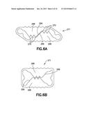 PLASTICALLY DEFORMABLE INTER-OSSEOUS DEVICE diagram and image