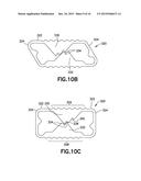 PLASTICALLY DEFORMABLE INTER-OSSEOUS DEVICE diagram and image