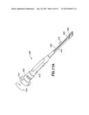 PLASTICALLY DEFORMABLE INTER-OSSEOUS DEVICE diagram and image