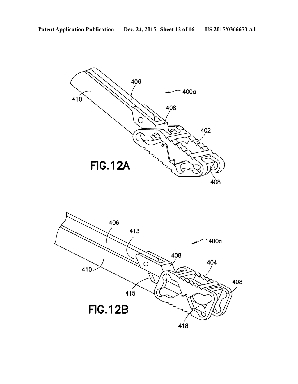 PLASTICALLY DEFORMABLE INTER-OSSEOUS DEVICE - diagram, schematic, and image 13