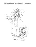 PROSTHETIC KNEE diagram and image