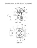 PROSTHETIC KNEE diagram and image