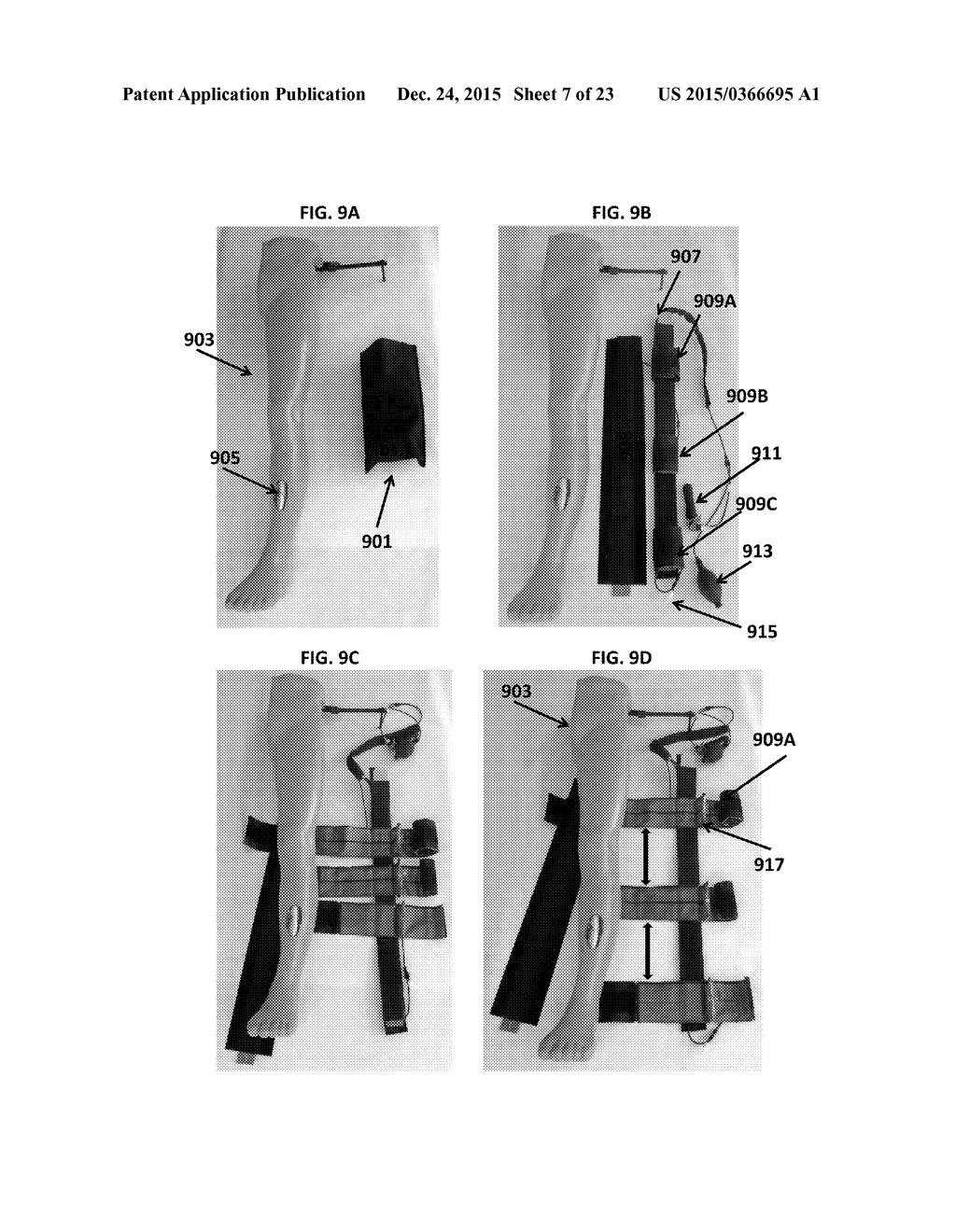 LIMB STABILIZATION DEVICE - diagram, schematic, and image 08