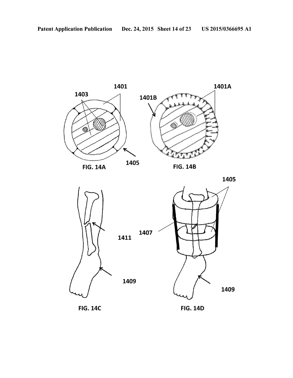 LIMB STABILIZATION DEVICE - diagram, schematic, and image 15