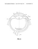 SMALL MOLECULE TRANSPORT DEVICE FOR DRUG DELIVERY OR WASTE REMOVAL diagram and image