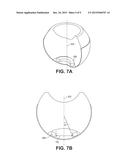 SMALL MOLECULE TRANSPORT DEVICE FOR DRUG DELIVERY OR WASTE REMOVAL diagram and image