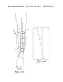 COMPRESSION DEVICE diagram and image