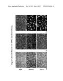 CONDUCTIVE BIOMATERIAL FOR ENHANCEMENT OF CONDUCTION IN VITRO AND IN VIVO diagram and image