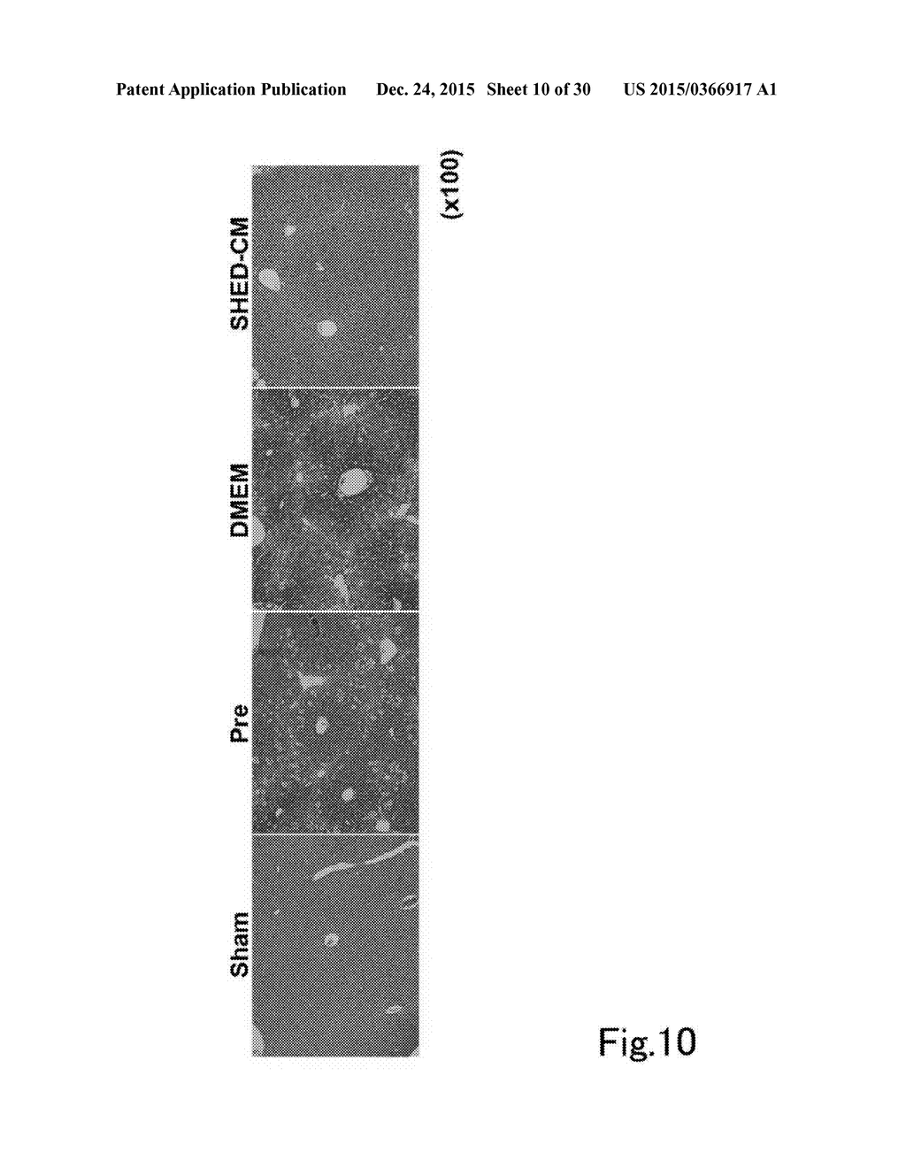 COMPOSITION FOR PREVENTING OR TREATING INFLAMMATORY DISEASE - diagram, schematic, and image 11