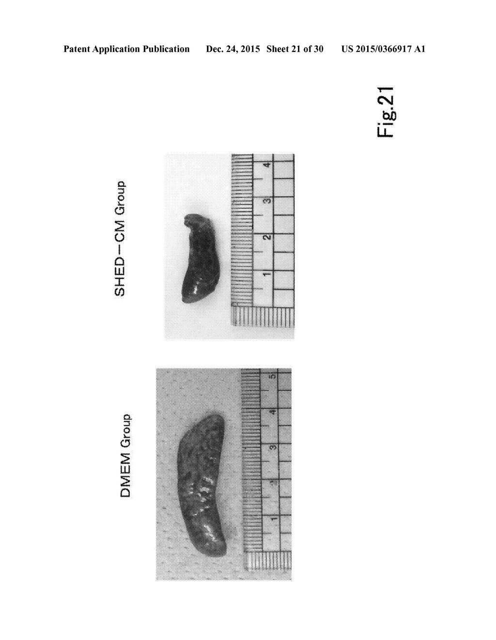 COMPOSITION FOR PREVENTING OR TREATING INFLAMMATORY DISEASE - diagram, schematic, and image 22