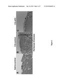 METHODS FOR REDUCING FIBROSIS INDUCED BY PERITONEAL DIALYSIS diagram and image