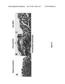 METHODS FOR REDUCING FIBROSIS INDUCED BY PERITONEAL DIALYSIS diagram and image