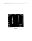 MAGNETIC MICROSTRUCTURES FOR MAGNETIC RESONANCE IMAGING diagram and image