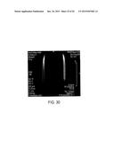 MAGNETIC MICROSTRUCTURES FOR MAGNETIC RESONANCE IMAGING diagram and image