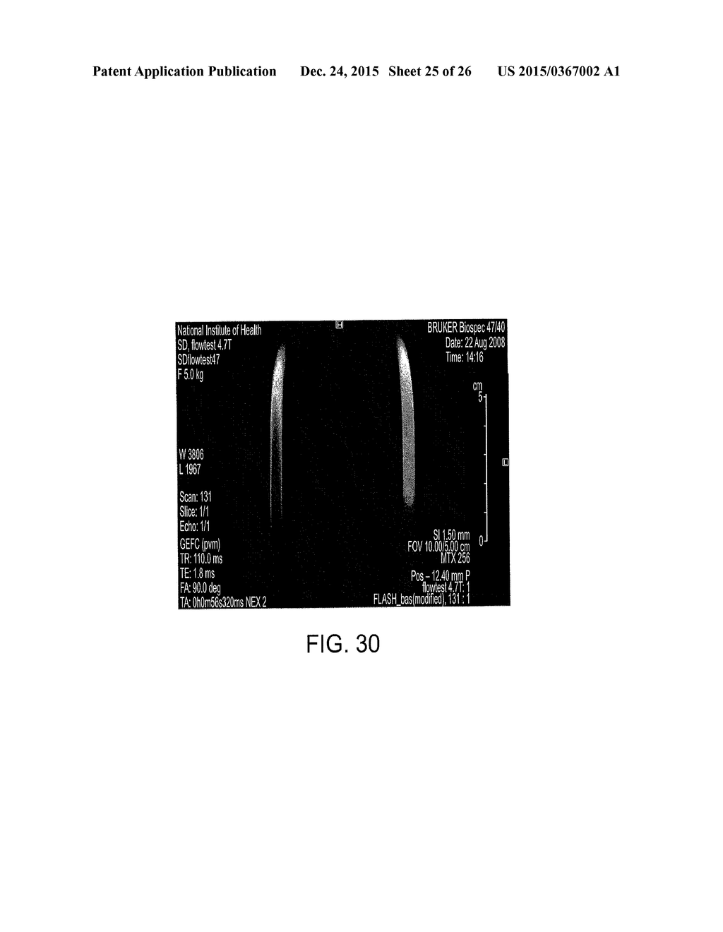 MAGNETIC MICROSTRUCTURES FOR MAGNETIC RESONANCE IMAGING - diagram, schematic, and image 26