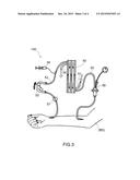 DIFFERENTIAL FLOW-METER FOR MEASURING THE WEIGHT LOSS IN HAEMODIALYSIS     TREATMENTS diagram and image