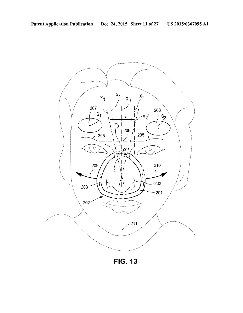 BREATHING MASK ARRANGEMENT AS WELL AS AN APPLICATION DEVICE AND A FOREHEAD     SUPPORT DEVICE FOR SAME - diagram, schematic, and image 12