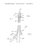 STRETCH VALVE BALLOON CATHETER AND METHODS FOR PRODUCING AND USING SAME diagram and image