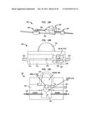 SYSTEMS AND METHODS FOR SHUNTING FLUID diagram and image