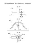 SYSTEMS AND METHODS FOR SHUNTING FLUID diagram and image