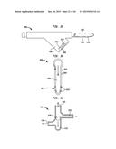 SYSTEMS AND METHODS FOR SHUNTING FLUID diagram and image