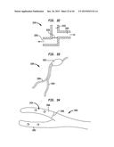 SYSTEMS AND METHODS FOR SHUNTING FLUID diagram and image