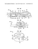 SYSTEMS AND METHODS FOR SHUNTING FLUID diagram and image