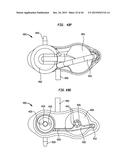 SYSTEMS AND METHODS FOR SHUNTING FLUID diagram and image