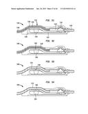 SYSTEMS AND METHODS FOR SHUNTING FLUID diagram and image