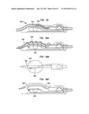 SYSTEMS AND METHODS FOR SHUNTING FLUID diagram and image