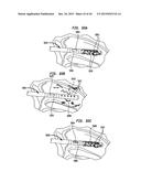 SYSTEMS AND METHODS FOR SHUNTING FLUID diagram and image