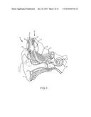 IMPLANTABLE AUDITORY PROSTHESIS HAVING ISOLATED COMPONENTS diagram and image